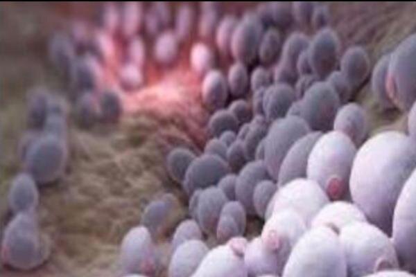 The Truth about Acne